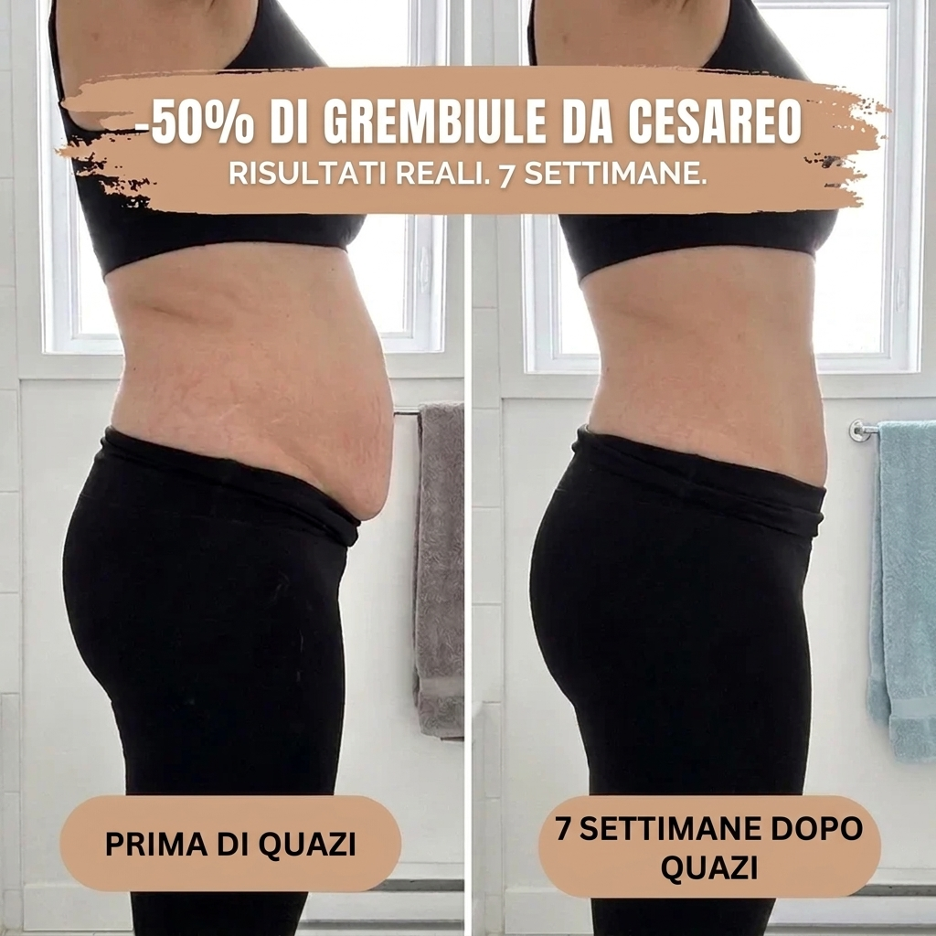 Slip Post-Parto — Compressione 360°